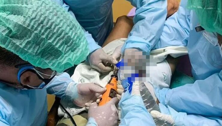 asma kilit fantezisi hastanede bitti! talihsiz adamın kangren olan cinsel organı kesildi