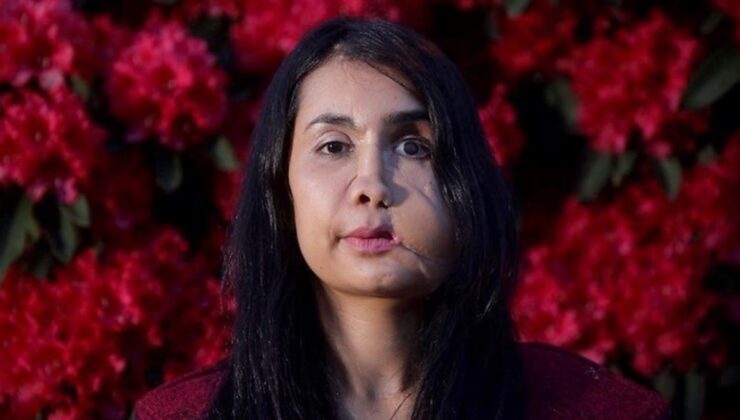 eşi tarafından suratından vurulan şakila zareen, afganistan’da kadınlara olan bakış açısını anlattı