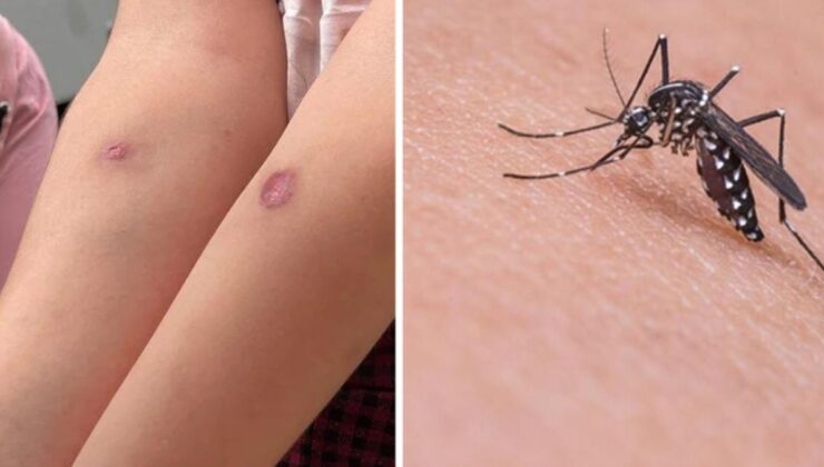 İstanbul’un yerleşik türleri arasına giren Asya kaplan sivrisineği için korkutan uyarı: Bulaşıcı hastalıklara neden olabilir