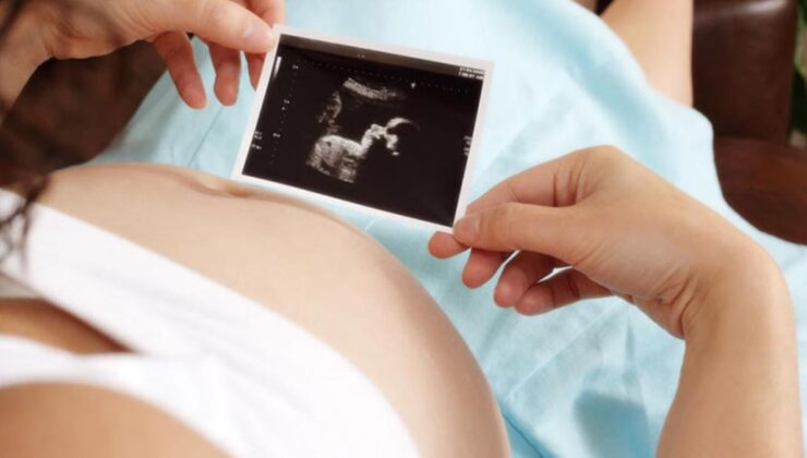 ultrason fotoğraflarına bakan anne, bebeğinin ürkütücü yüzüyle karşılaştı